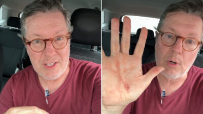 Montagem com fotos do vídeo em que Márcio Gomes mostra ferimento na mão durante tentativa de assalto em São Paulo