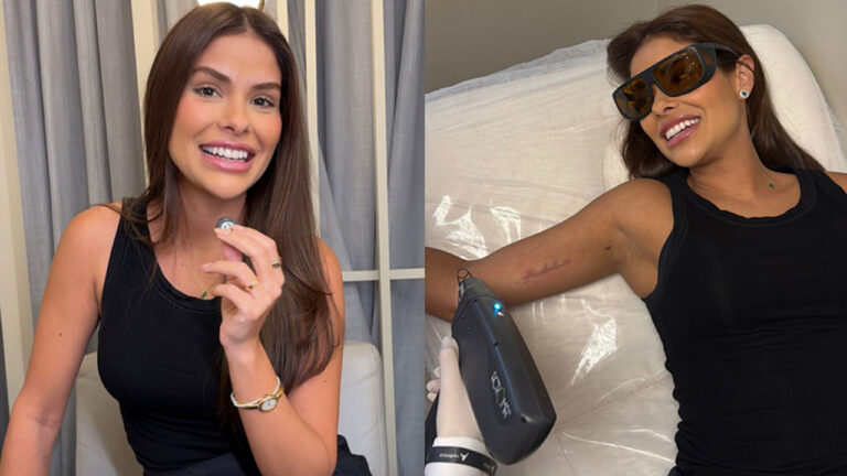 Munik Nunes aparece sorridente e durante sessão de remoção de tatuagem a laser no braço